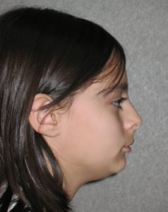 Alexis L before profile