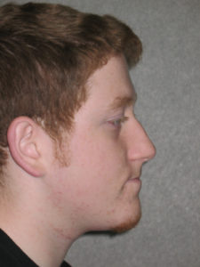David C. before profile