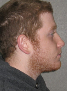 David C. after profile