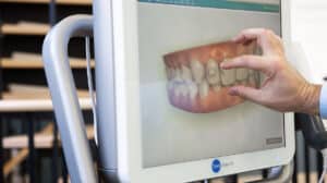 Learn about Adult Treatment